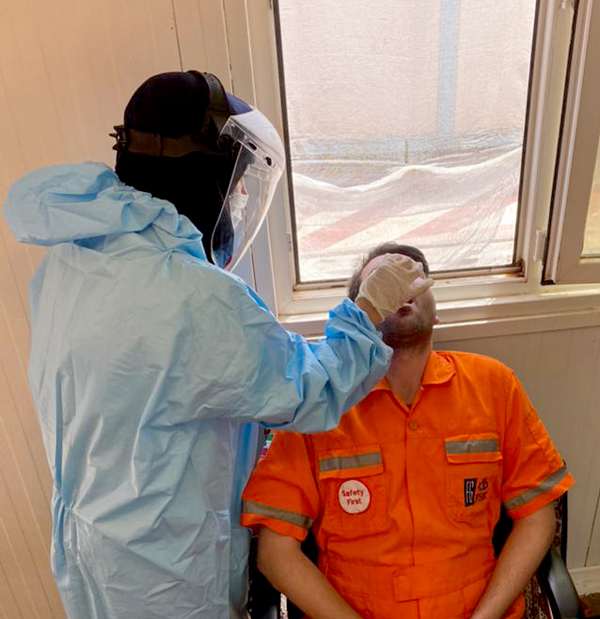 تست رپید سکو 1