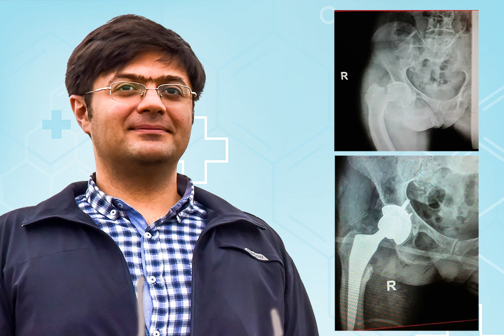 تعویض لگن هیپ دکتر کرمانی